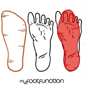 Animated diagram comparing the common shoe sole shape to the average foot. Showcasing how the shapes of our shoes do not match the shapes of our feet. The big and pinky toe naturally point straight and outwards, but the common shoe shape does not permit this. 